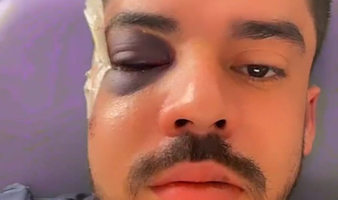 Caso rapper Uryel Rhander: Violência injustificável lembra o caso Marco Antônio Velasco