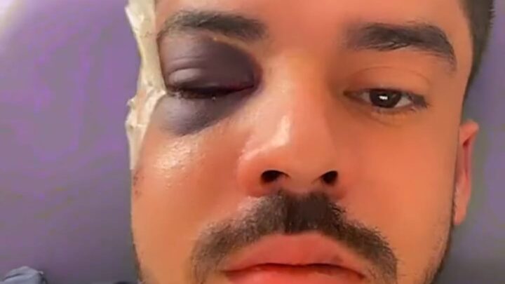 Caso rapper Uryel Rhander: Violência injustificável lembra o caso Marco Antônio Velasco